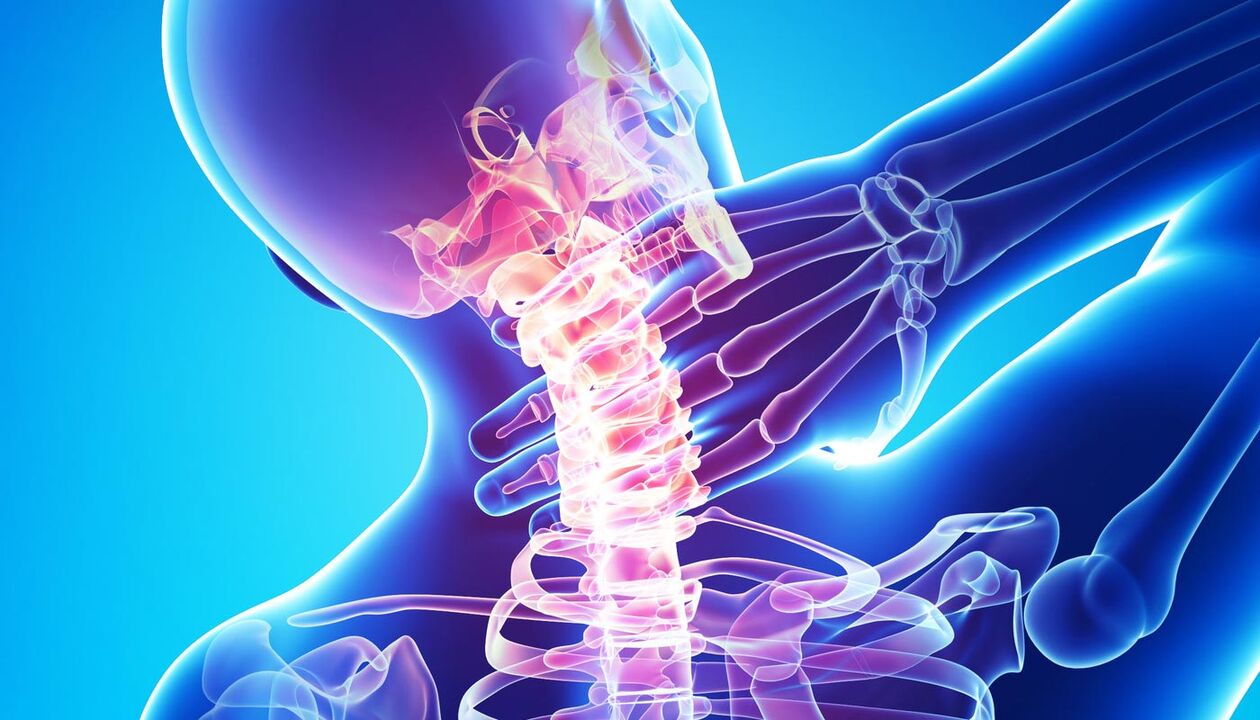 Dor de pescozo por osteocondrose