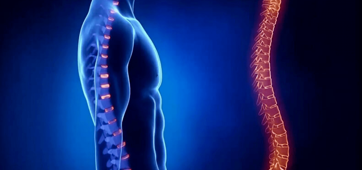 Lesións da columna vertebral por osteocondrose