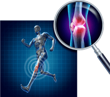 Osteoartrite da articulación do xeonllo